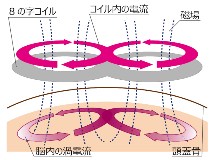 図：8の字コイルへの瞬間的な通電で発生した磁場が、頭蓋骨を貫通して脳内に渦電流を生じさせます。